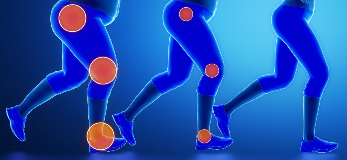 Extra body overweight affects ankle pain, creates stress
