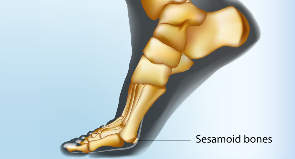 Some people experience injuries in the sesamoid bone
